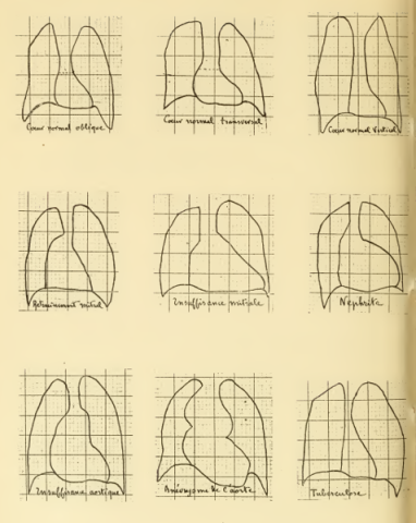 orthodiagramme